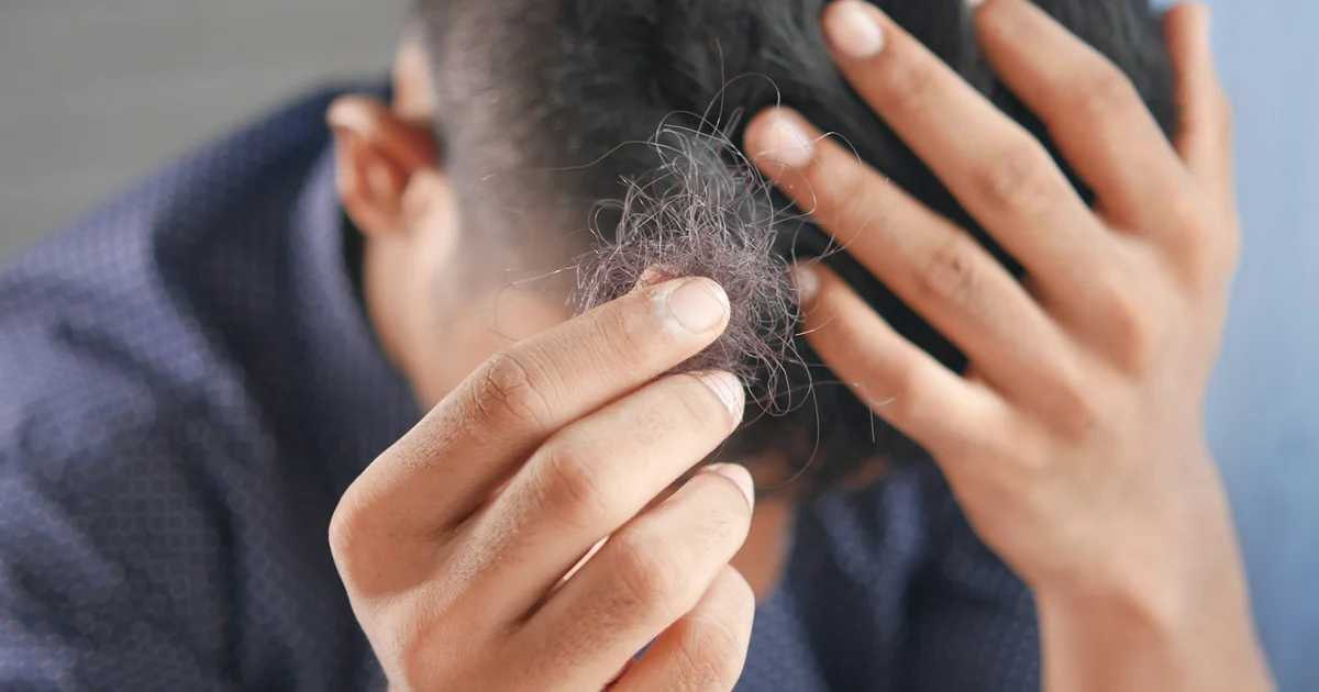 Best Hair Loss Treatments 2025