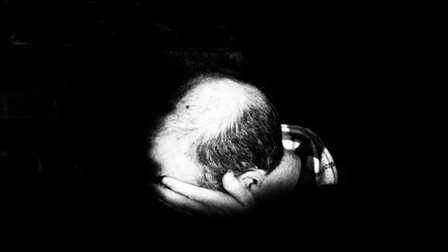Minoxidil: Myth or Miracle? Does It Really Work for Hair Loss?